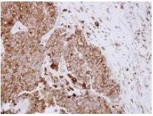 Immunohistochemistry (Formalin/PFA-fixed paraffin-embedded sections) - Anti-ASAH1 antibody (AB154401)