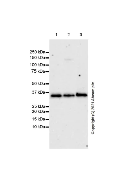 Western blot - Anti-ASAH1 antibody [EPR24476-30] (AB282276)