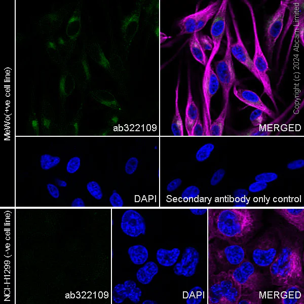Immunocytochemistry/ Immunofluorescence - Anti-ASAH1 antibody [MJF-D29767-517] (AB322109)