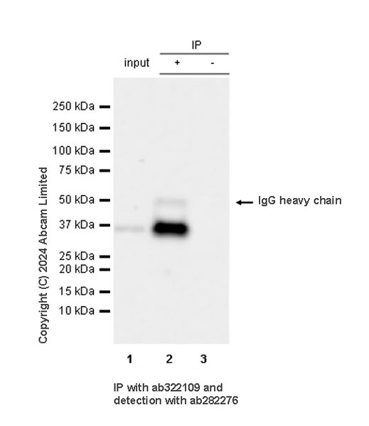 Immunoprecipitation - Anti-ASAH1 antibody [MJF-D29767-517] (AB322109), expandable thumbnail