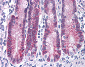 Immunohistochemistry (Formalin/PFA-fixed paraffin-embedded sections) - Anti-ASAH2 antibody (AB113369)