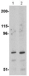 Western blot - Anti-ASAH2 antibody (AB113369)