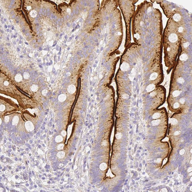 Immunohistochemistry (Formalin/PFA-fixed paraffin-embedded sections) - Anti-ASAH2 antibody (AB252990), expandable thumbnail