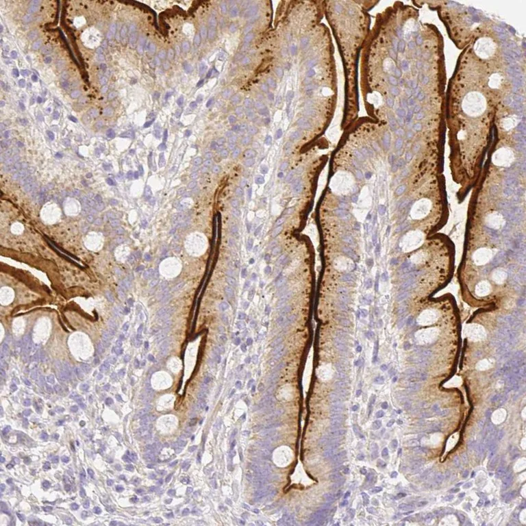 Immunohistochemistry (Formalin/PFA-fixed paraffin-embedded sections) - Anti-ASAH2 antibody (AB252990)