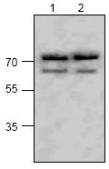 Western blot - Anti-ASAH2 antibody (AB63804)