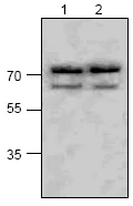 Western blot - Anti-ASAH2 antibody (AB63804)