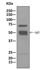 Immunoprecipitation - Anti-ASAH2B antibody [EPR10539] - BSA and Azide free (AB249617), expandable thumbnail
