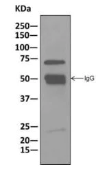 Immunoprecipitation - Anti-ASAH2B antibody [EPR10539] - BSA and Azide free (AB249617)