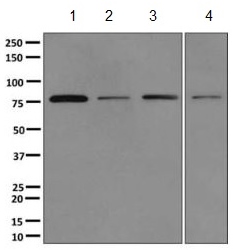 Western blot - Anti-ASAH2B antibody [EPR10539] - BSA and Azide free (AB249617), expandable thumbnail