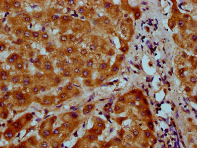 Immunohistochemistry (Formalin/PFA-fixed paraffin-embedded sections) - Anti-ASAHL/PLT antibody (AB238726)
