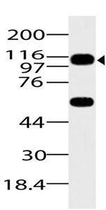 Western blot - Anti-ASAP1 / DDEF1 antibody (AB208170)