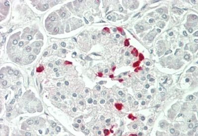 Immunohistochemistry (Formalin/PFA-fixed paraffin-embedded sections) - Anti-ASAP2 antibody (AB230841)