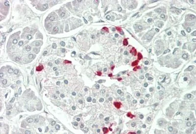 Immunohistochemistry (Formalin/PFA-fixed paraffin-embedded sections) - Anti-ASAP2 antibody (AB230841)