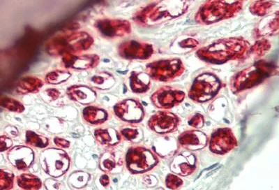 Immunohistochemistry (Formalin/PFA-fixed paraffin-embedded sections) - Anti-ASAP2 antibody (AB230841)