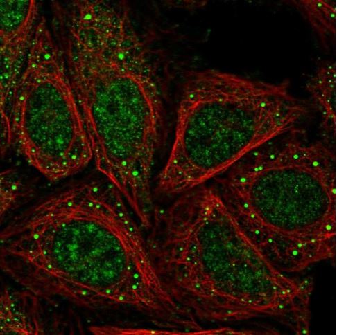 Immunocytochemistry/ Immunofluorescence - Anti-ASAP3 antibody (AB187885), expandable thumbnail