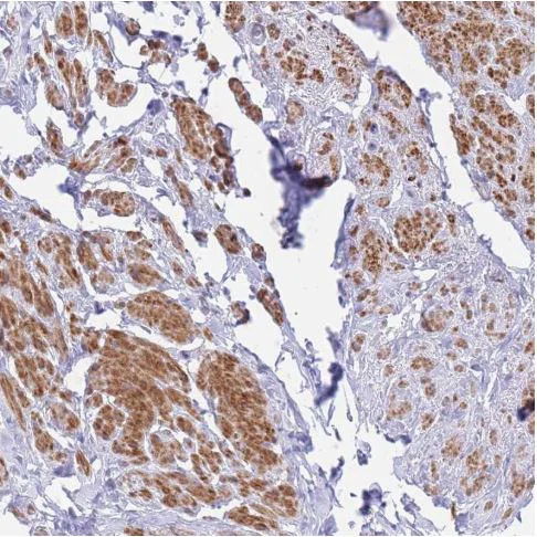 Immunohistochemistry (Formalin/PFA-fixed paraffin-embedded sections) - Anti-ASAP3 antibody (AB187885)