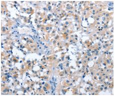 Immunohistochemistry (Formalin/PFA-fixed paraffin-embedded sections) - Anti-ASB2 antibody (AB200370), expandable thumbnail