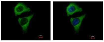 Immunocytochemistry/ Immunofluorescence - Anti-ASB8 antibody (AB227475)