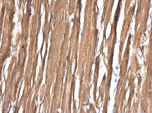 Immunohistochemistry (Formalin/PFA-fixed paraffin-embedded sections) - Anti-ASB8 antibody (AB227475)