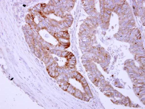 Immunohistochemistry (Formalin/PFA-fixed paraffin-embedded sections) - Anti-ASB8 antibody (AB227475)
