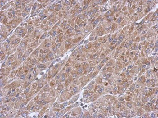 Immunohistochemistry (Formalin/PFA-fixed paraffin-embedded sections) - Anti-ASB8 antibody (AB227475)