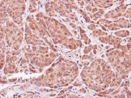 Immunohistochemistry (Formalin/PFA-fixed paraffin-embedded sections) - Anti-ASB9 antibody (AB97918)