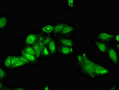 Immunocytochemistry/ Immunofluorescence - Anti-ASC1 antibody (AB236996)