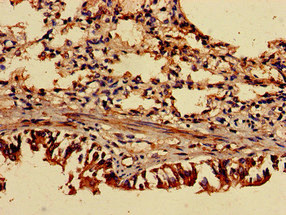 Immunohistochemistry (Formalin/PFA-fixed paraffin-embedded sections) - Anti-ASC1 antibody (AB236996)