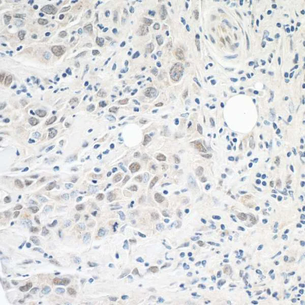 Immunohistochemistry (Formalin/PFA-fixed paraffin-embedded sections) - Anti-ASC1 antibody (AB70627)