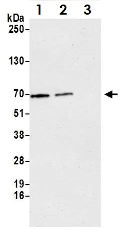 Immunoprecipitation - Anti-ASC1 antibody (AB70627)