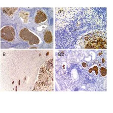 Immunohistochemistry (Formalin/PFA-fixed paraffin-embedded sections) - Anti-ASC2/ASCI antibody (AB47092)