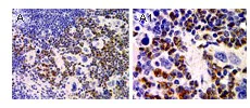 Immunohistochemistry (Formalin/PFA-fixed paraffin-embedded sections) - Anti-ASC2/ASCI antibody (AB47092)