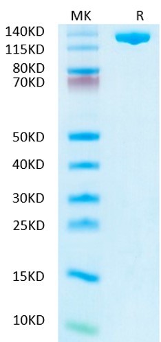 SDS-PAGE - AsCas12a (Active) (AB316171), expandable thumbnail