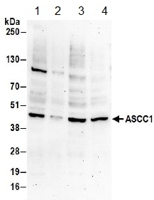 Western blot - Anti-ASCC1 antibody (AB157102)