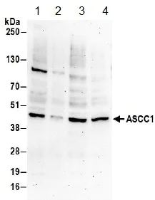 Western blot - Anti-ASCC1 antibody (AB157102)