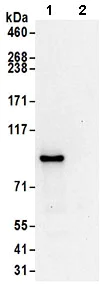 Immunoprecipitation - Anti-ASCC2 antibody (AB168811)