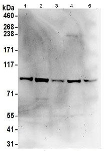 Western blot - Anti-ASCC2 antibody (AB168811)