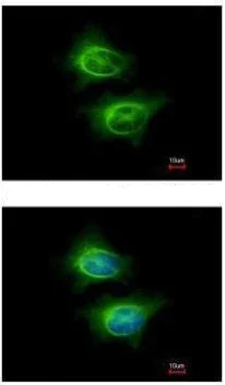 Immunocytochemistry/ Immunofluorescence - Anti-ASCC2 antibody (AB228827)