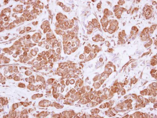 Immunohistochemistry (Formalin/PFA-fixed paraffin-embedded sections) - Anti-ASCC2 antibody (AB228827)