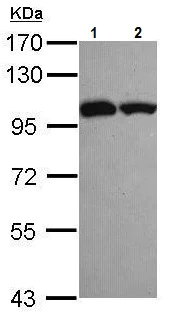 Western blot - Anti-ASCC2 antibody (AB228827)