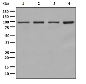 Western blot - Anti-ASCC2 antibody [EPR9773] - BSA and Azide free (AB248946)