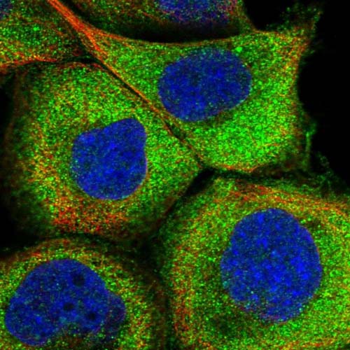 Immunocytochemistry/ Immunofluorescence - Anti-ASCC3 antibody (AB122180), expandable thumbnail