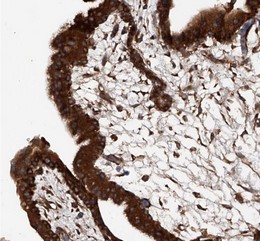 Immunohistochemistry (Formalin/PFA-fixed paraffin-embedded sections) - Anti-ASCC3 antibody (AB122180), expandable thumbnail