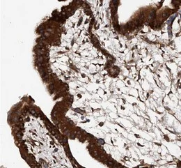 Immunohistochemistry (Formalin/PFA-fixed paraffin-embedded sections) - Anti-ASCC3 antibody (AB122180)