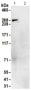 Immunoprecipitation - Anti-ASCC3 antibody (AB168810)