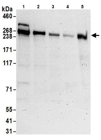 Western blot - Anti-ASCC3 antibody (AB226191)