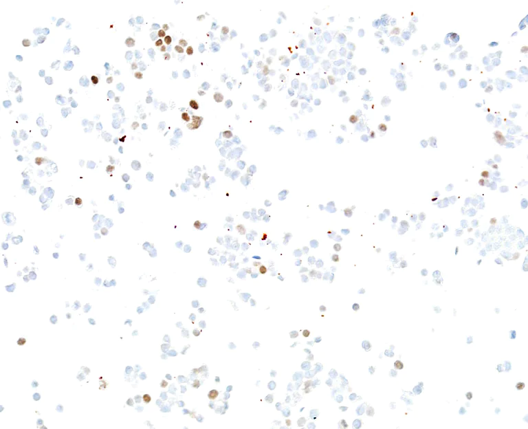Immunocytochemistry - Anti-ASCL1/MASH1 antibody [BLR164J] - BSA free (AB314100)