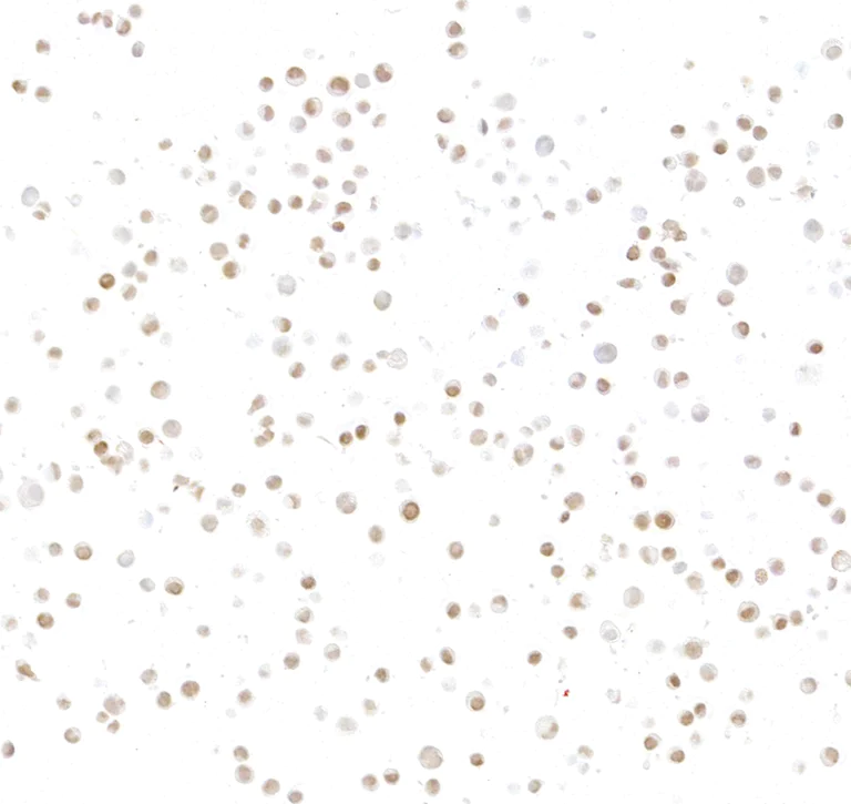 Immunocytochemistry - Anti-ASCL1/MASH1 antibody [BLR164J] - BSA free (AB314100)