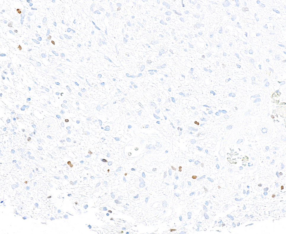 Immunohistochemistry (Formalin/PFA-fixed paraffin-embedded sections) - Anti-ASCL1/MASH1 antibody [BLR164J] - BSA free (AB314100), expandable thumbnail