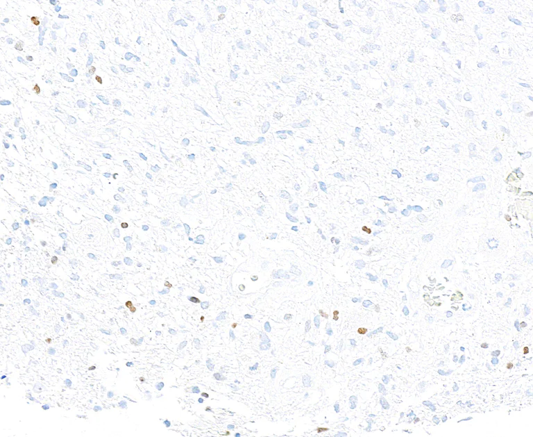 Immunohistochemistry (Formalin/PFA-fixed paraffin-embedded sections) - Anti-ASCL1/MASH1 antibody [BLR164J] - BSA free (AB314100)